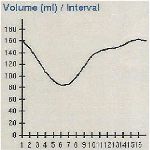 Courbe VG volume - temps 