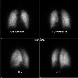 Perfusion