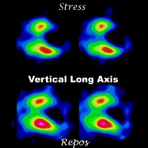 Coupes verticales long axe