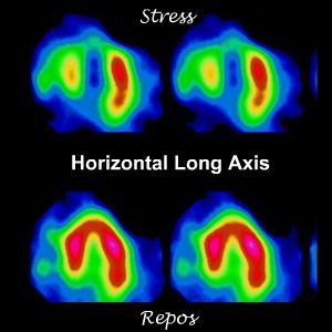 Coupes horizontal long axe