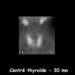 Centré thyroïde - 30 mn