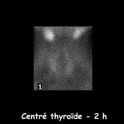 Centré thyroïde - 2 h