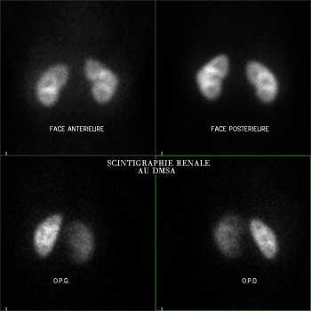 Images statiques