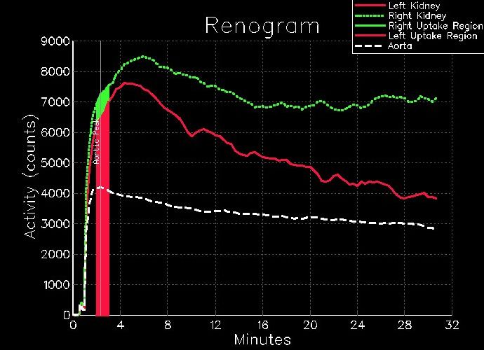 Rénogramme post-Captopril®