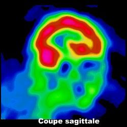 Coupe sagittale