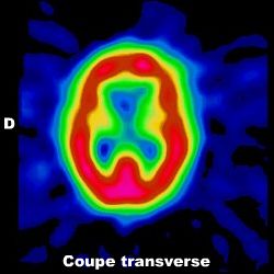 Coupe transverse