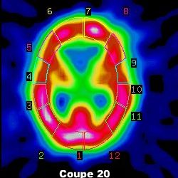 Quantification coupe 20