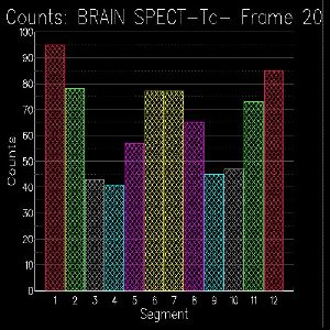 Quantification coupe 20