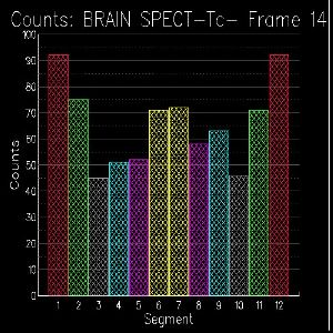 Quantification coupe 14