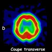 Coupe transverse