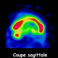 Coupe sagittale