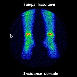 Temps tissulaire - Pieds vue dorsale