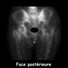 Bassin - Face postérieure