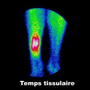 Temps tissulaire