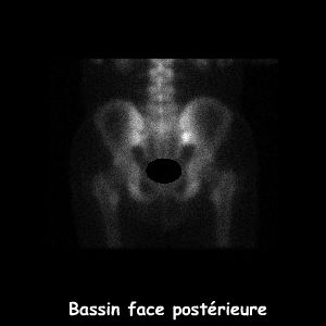 Bassin face postérieure