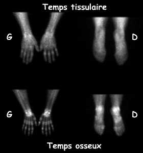 Temps tissulaire et temps osseux