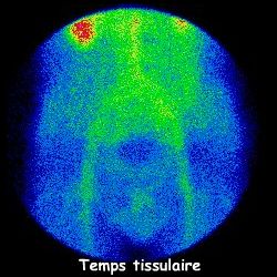 Temps tissulaire