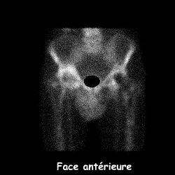 Temps osseux - Face antérieure