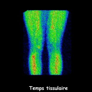 Temps tissulaire