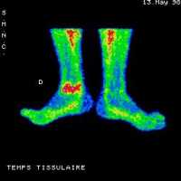 Temps tissulaire