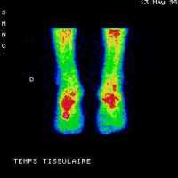 Temps tissulaire