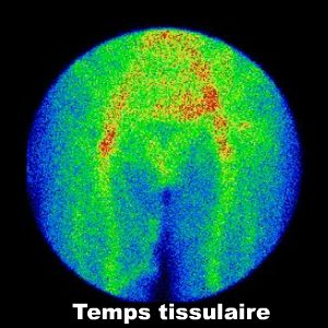 Temps tissulaire