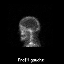 Profil gauche