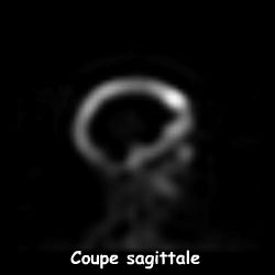 Coupe sagittale