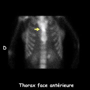 Thorax face antérieure