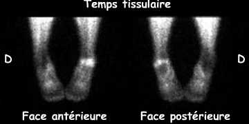 Temps tissulaire